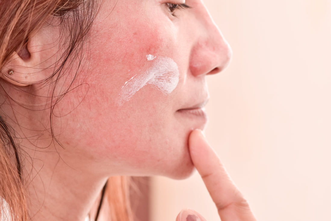 Sensitive skin
